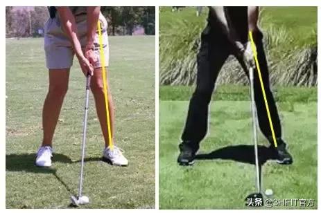 女性膝关节疼痛的最好治疗方法,为什么女性膝关节更容易出问题