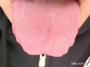 舌头反映了身体的哪些器官,舌头出现信号对身体有什么危险