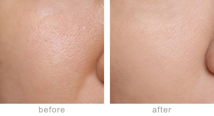 最近最火的粉底液,比较推荐的几款粉底液