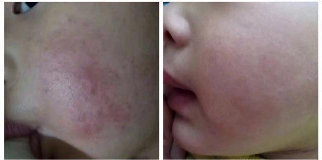 强生婴儿面霜防皲裂老款,强生婴儿面霜最新版