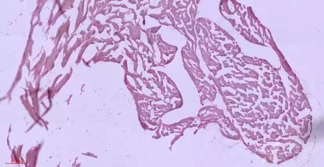 腘绳肌拉伤二级拉伤,腘绳肌拉伤如何判断是肌腱拉伤