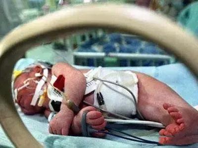 女子意外怀孕结果生了怪胎,女人怀孕生宝宝被吓坏