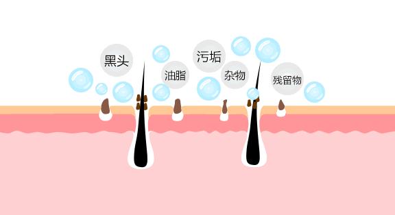 毛孔很大像窟窿一样是怎么导致的,毛孔大像蜂窝