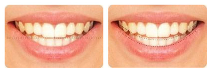 美丽人生从牙齿出发,美丽人生从口腔护理开始