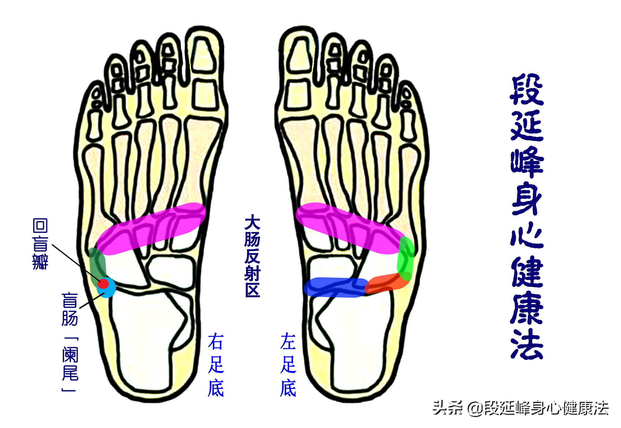 心中有术三个小妙招解决便秘,便秘费力怎么办