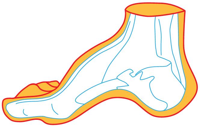 足弓塌陷导致膝盖疼痛如何治疗,足弓塌陷脚掌疼怎么缓解