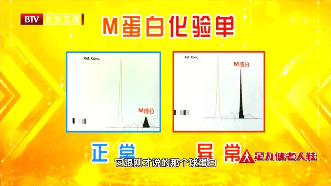 比腰肌劳损严重的是什么,比腰肌劳损还严重的是什么病