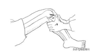 怎么判断交叉韧带损伤,膝关节交叉韧带损伤专家