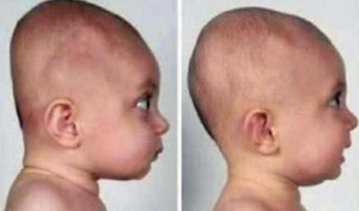 宝宝后脑勺高就是高智商的象征,有前脑勺后脑勺宝宝聪明吗