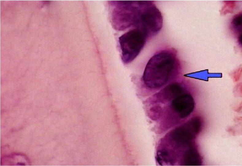 骨科基础知识——你知道多少之成骨细胞