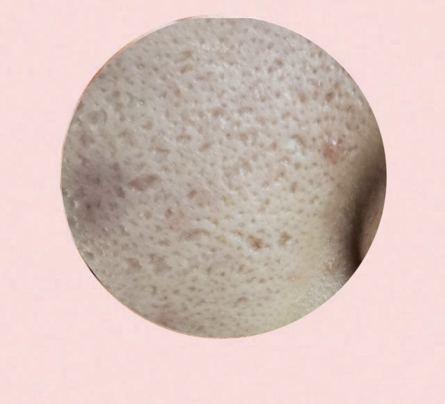 油皮毛孔大泛红怎么改善,干皮毛孔粗大怎么改善小妙招