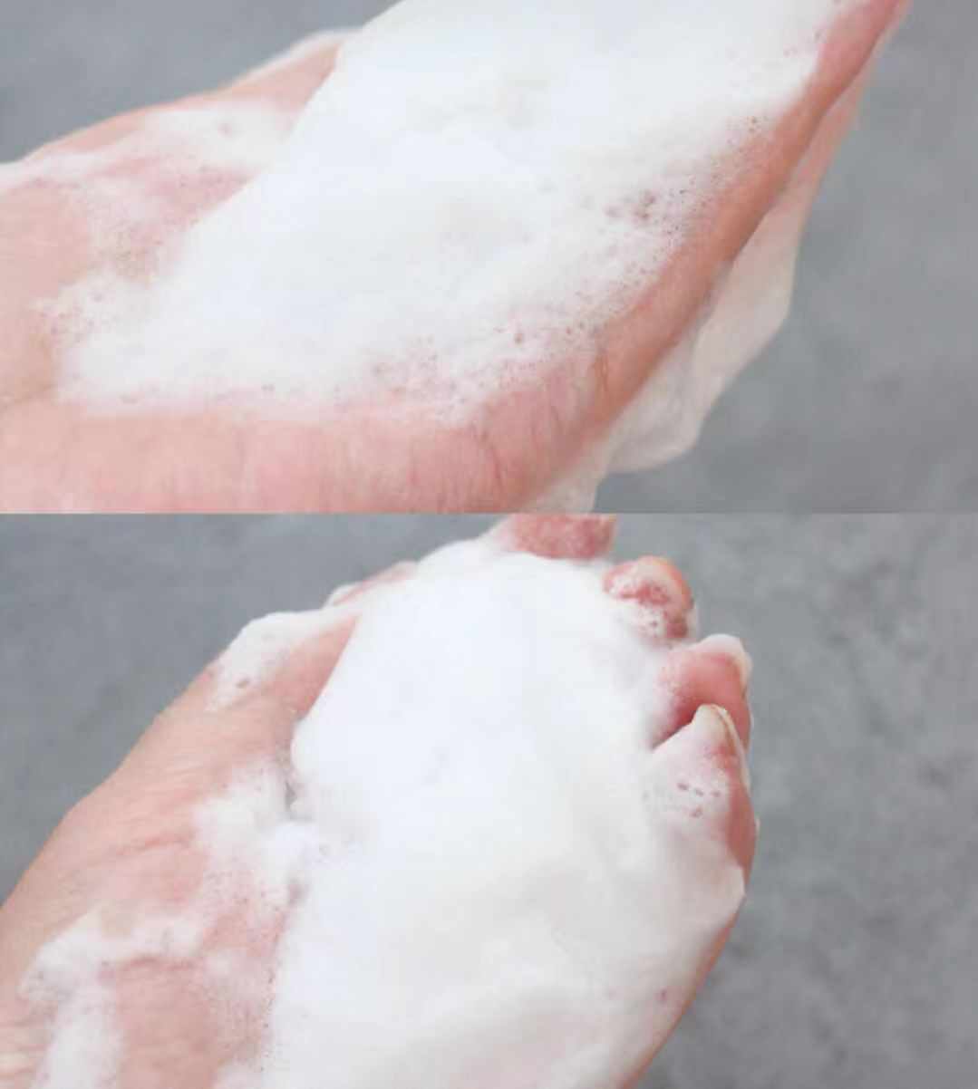 赵丽颖黑头,赵丽颖素颜照片真实对比