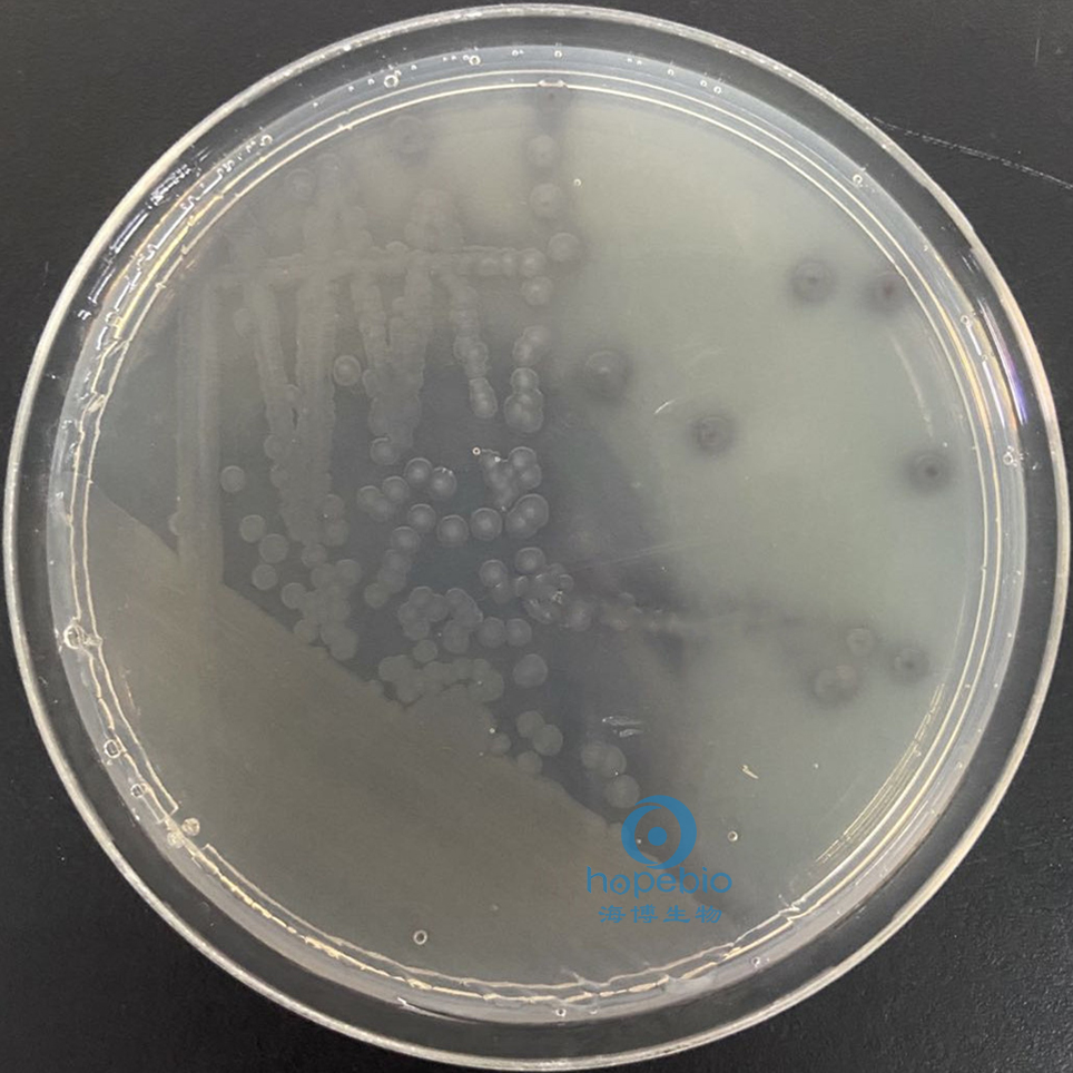 霍乱弧菌分型鉴定,霍乱弧菌的鉴定方法有几种