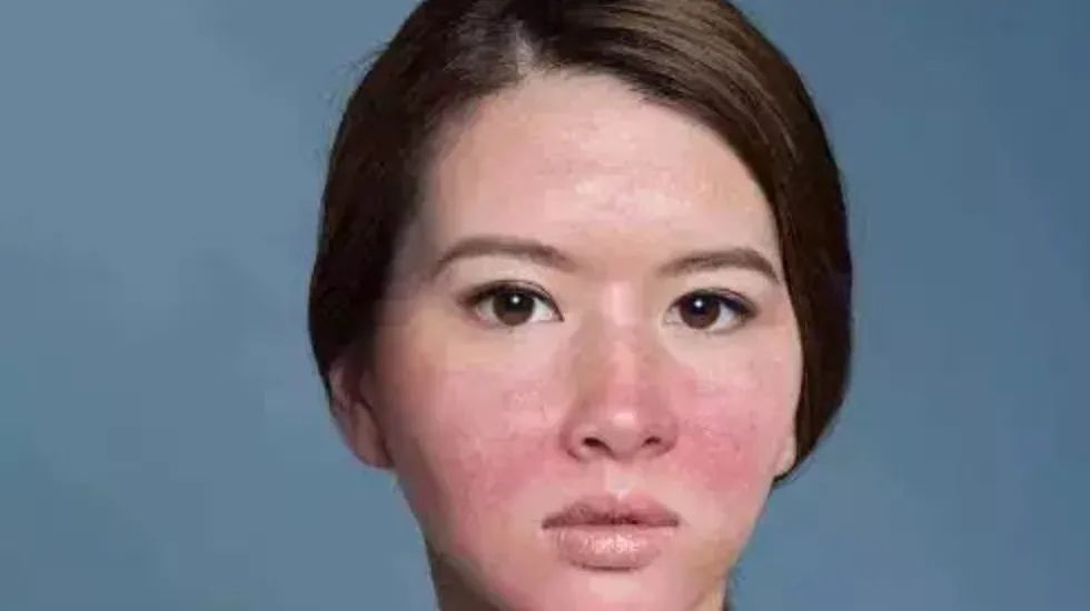 颜值杀手薇尔莉特,常见的影响颜值的皮肤病