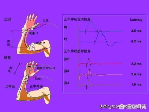 颈椎痛手臂麻有几种治疗方法,颈椎病手麻按脖子的哪一根筋