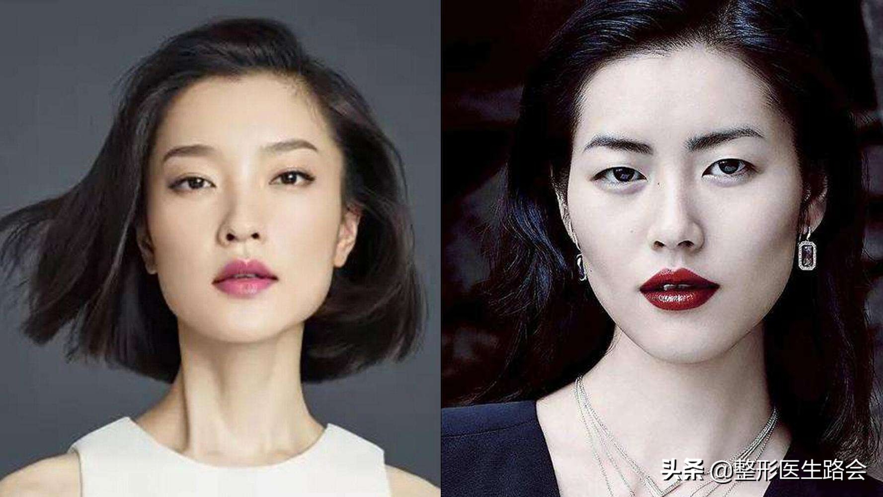 颧骨磨骨苹果肌下垂如何修复,如何判断是苹果肌还是高颧骨