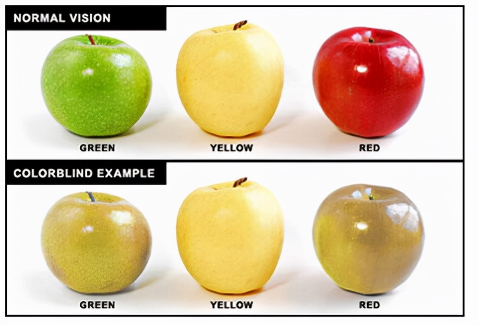 脱发与打鼾有关系吗,打呼噜和脱发的关系