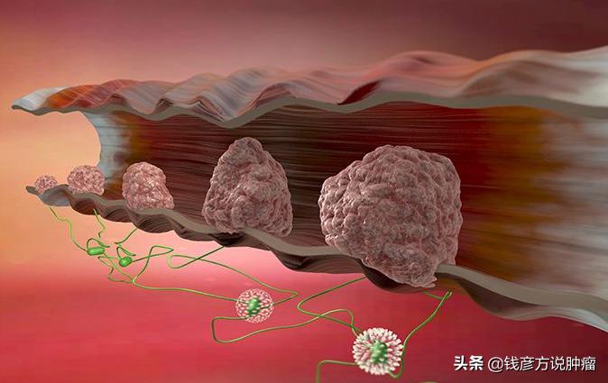 中医治疗结节增生囊肿息肉的优势,身上各种结节息肉吃中药能治愈吗