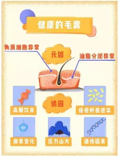 怎么去除脸上痘印痘坑痘痕,预防痘坑买什么