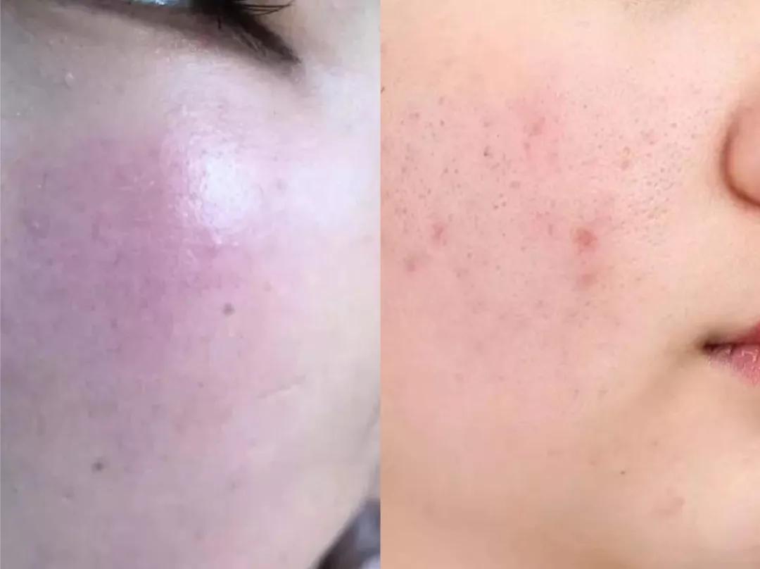 快用完的洗面奶,真正有效的清洁毛孔的洗面奶