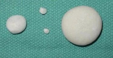 猫尿结石怎么治,猫尿不出尿有结石怎么治疗