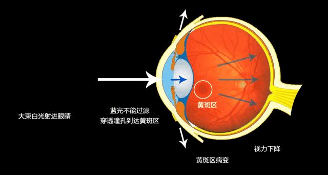 护眼显示器真的护眼吗,显示器护眼技术是骗人的吗