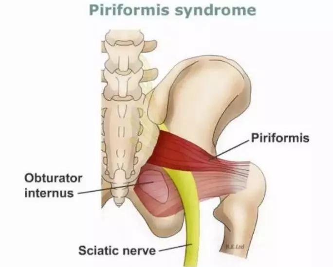 是不是每个人的腰突症状都不一样,不是腰突但是腿疼腿麻是怎么回事