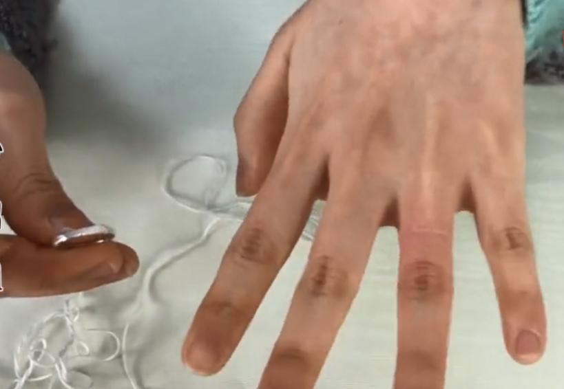 戒指取不下来别着急一招轻松解决,戒指戴手上肿胀取不下来怎么办