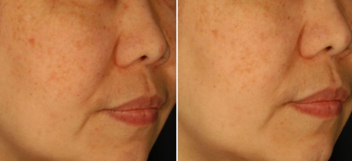 双11最后一波捡漏清单速速上车,双11预售21号开启预订更优惠