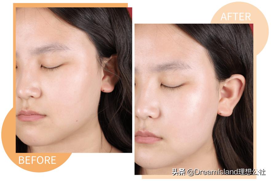 天天戴口罩皮肤会变好吗,天天戴口罩脸会变黑吗