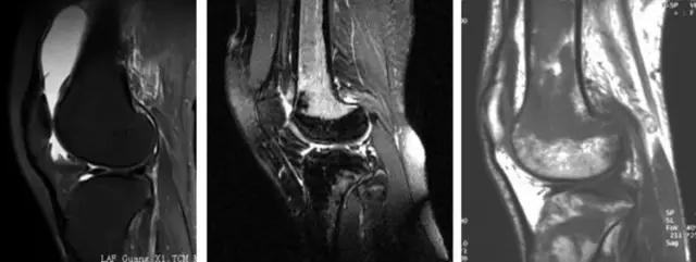 mri临床医师必读电子书,临床医生如何读mri