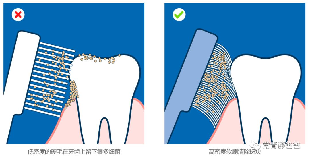孩子有了龋齿刷牙还有用吗,用牙线清理牙缝很臭是蛀牙吗