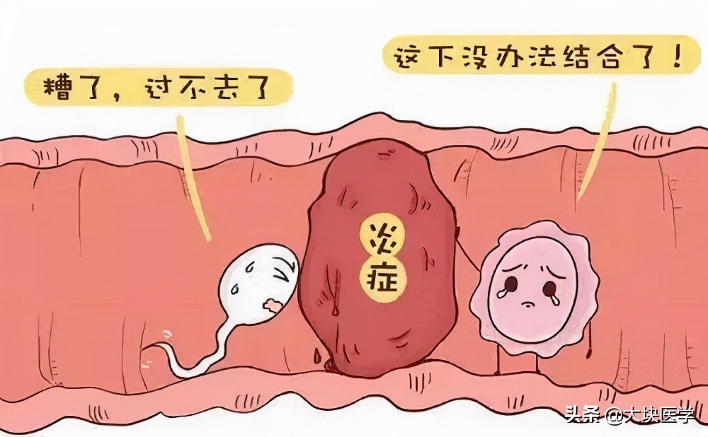 女性腰疼是妇科病的哪一种,女性妇科病腰疼