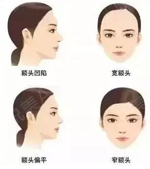 自体脂肪丰唇需要哪些准备,自体脂肪填充术前准备