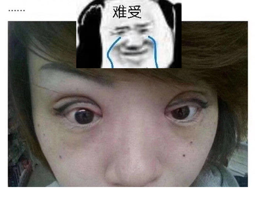 整形医院做双眼皮怎么不被坑,整形医院做双眼皮失败如何投诉