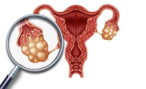 常见的子宫疾病有几种,和子宫有关的妇科疾病