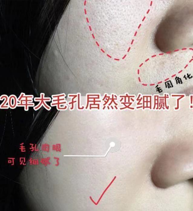 19岁女生打“美容针”脸肿得像包子，到医院检查，医生怒斥：无知