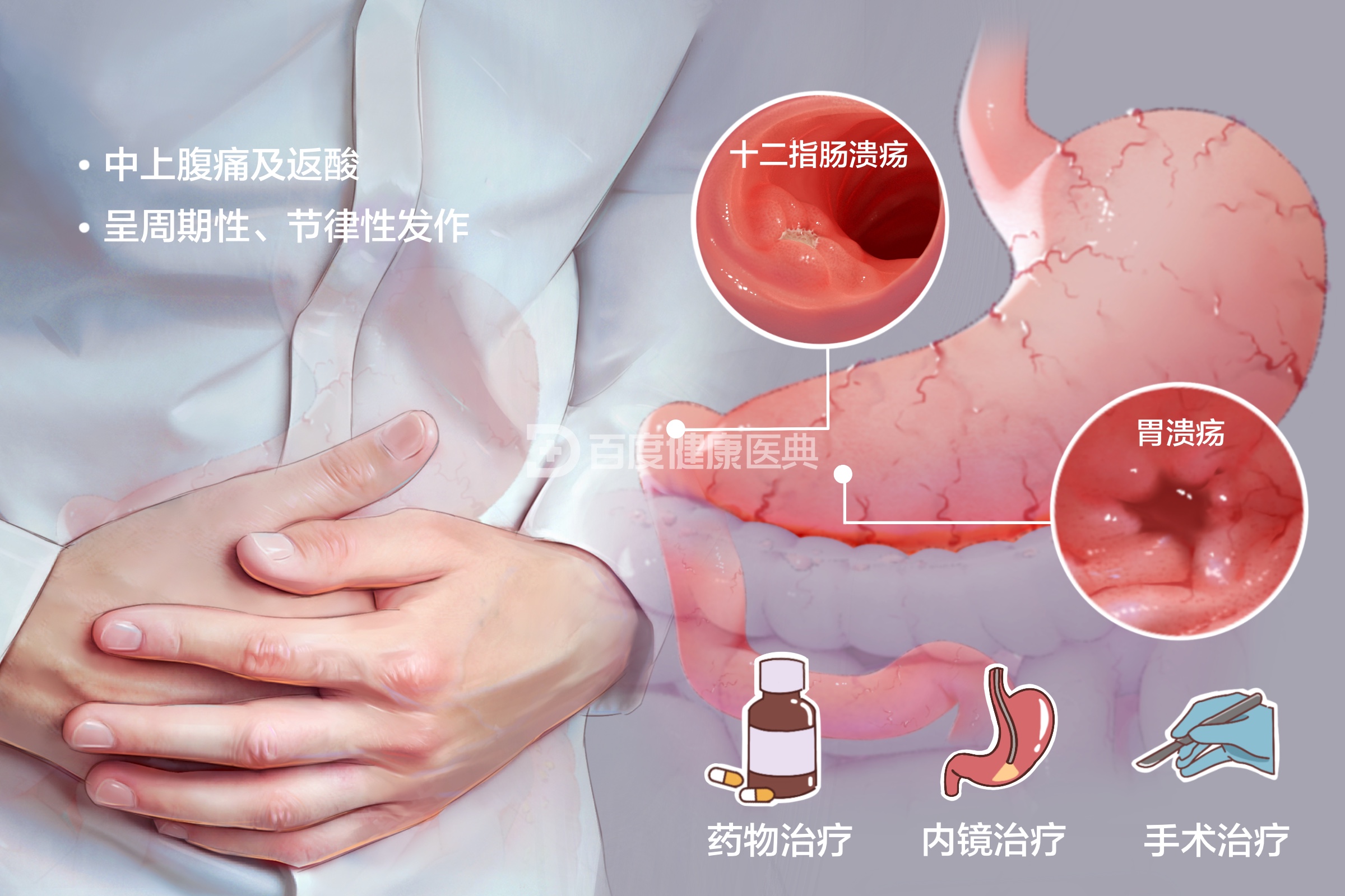 若你“大便出血”可能是患有以下疾病