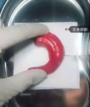 我在快手上看人切洋葱，竟然弄懂了剖腹产？