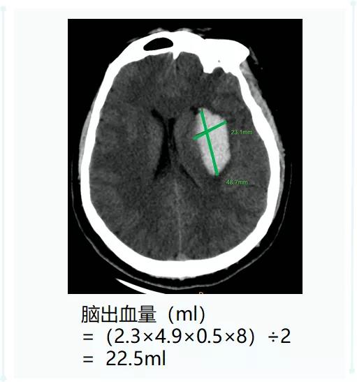 ct后处理重建技术,ct后处理技巧