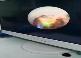 山东治疗泌尿外科比较好的医院,山东大学附属医院泌尿外科专家