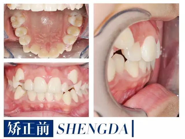 山西“爱马仕”级别齿科医院！get明星同款笑容