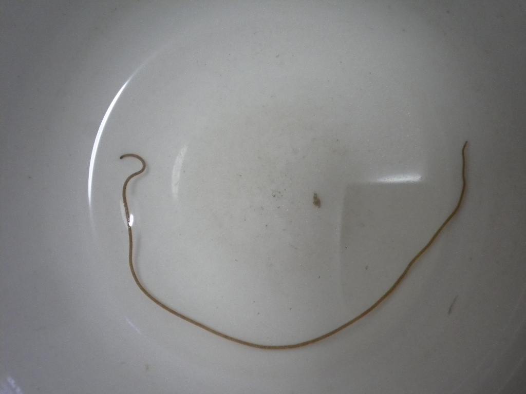 鱼类身上最常见的寄生虫长什么样,23种常见鱼类寄生虫高清图谱