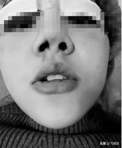 整形行业的现状,整形行业未来会淘汰吗