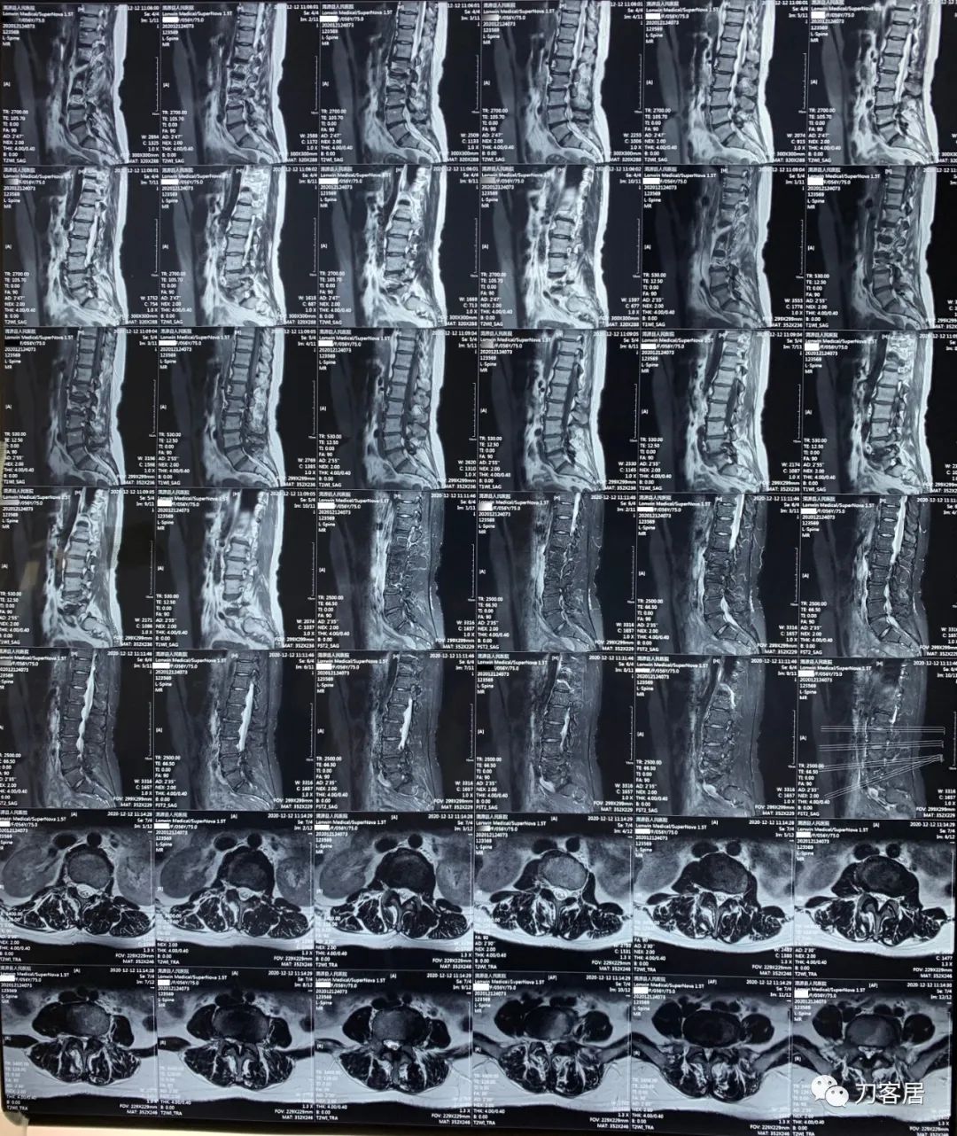 我的门诊病历,我的门诊