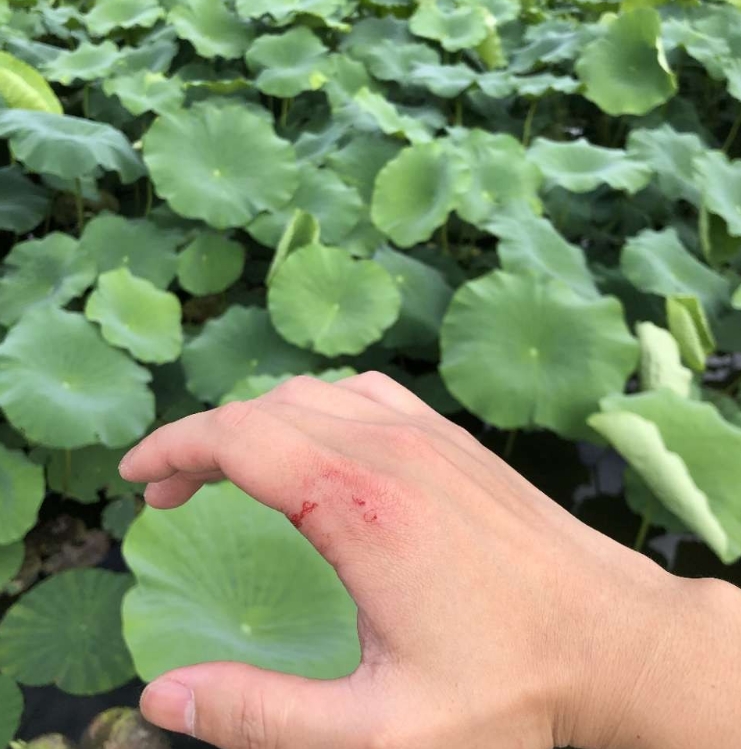 浙江一男子钓鱼差点被鱼拉下水,男子钓鱼被鱼咬后续