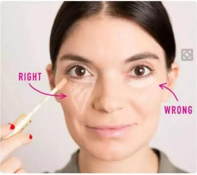 黑眼圈色斑严重怎么办,去除色素型黑眼圈的最快方法