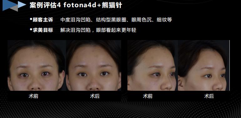 胶生灌养眼周抗衰是什么产品?