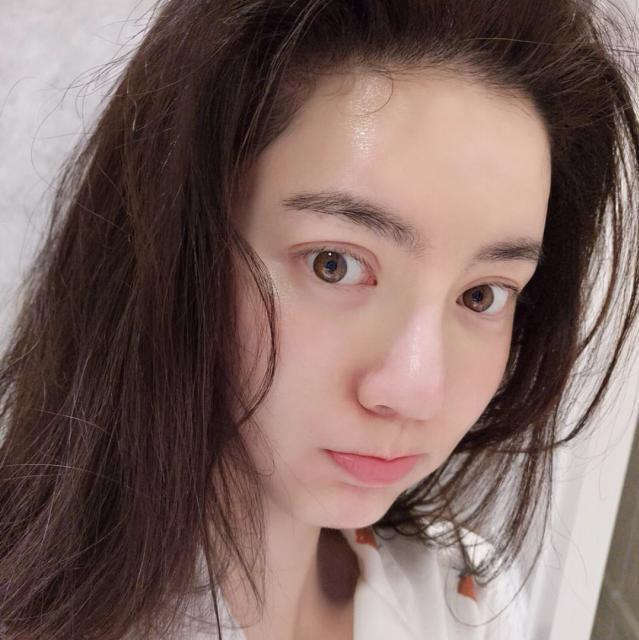 脸部毛孔粗大的原因及改善方法,脸部毛孔粗大有什么办法解决