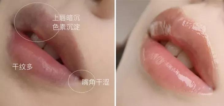 迪丽热巴嘴唇厚,正确脸部护肤步骤迪丽热巴